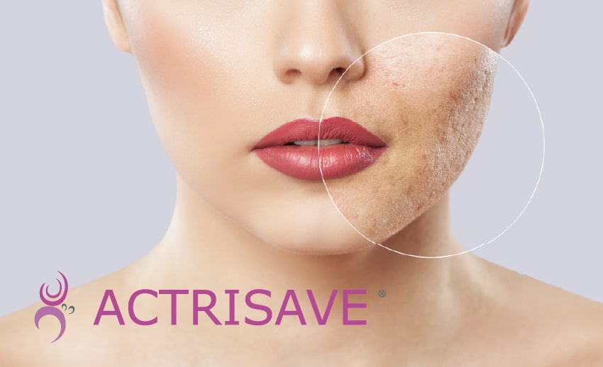 Immagine dell'opzione prodotto